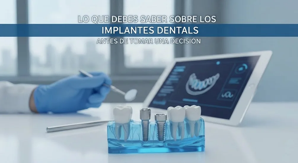 implantes dentales