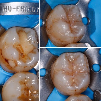 Foto de Acedo Dental El Barco de Ávila