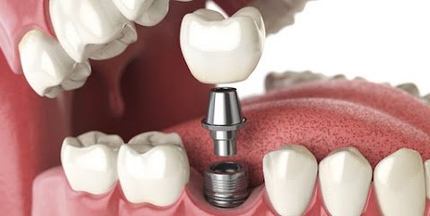 Foto de CENTRO MEDICO DENTAL Y MAXILOFACIAL ALCALA DE HENARES