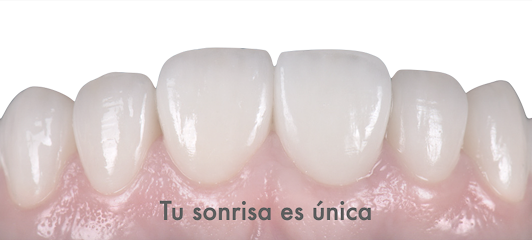 Foto de Clínica Dental MiBO Almería