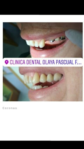 Foto de Clínica dental Olaya Pascual Fombella