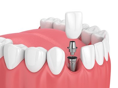 Foto de Massi Clínica Dental